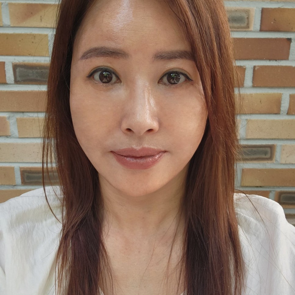 Looking for a Clinic to Reverse Sagging Without Mini Lower Blepharoplasty Scars? image 1