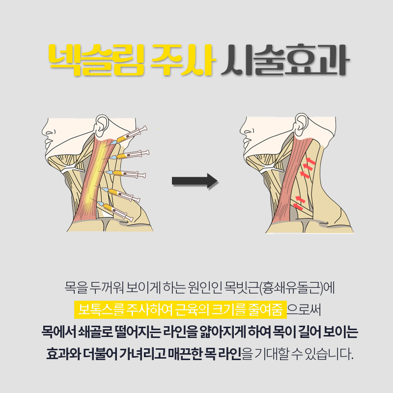 넥슬림주사가 목살도 같이 빼 줄까요? 관련 이미지 4