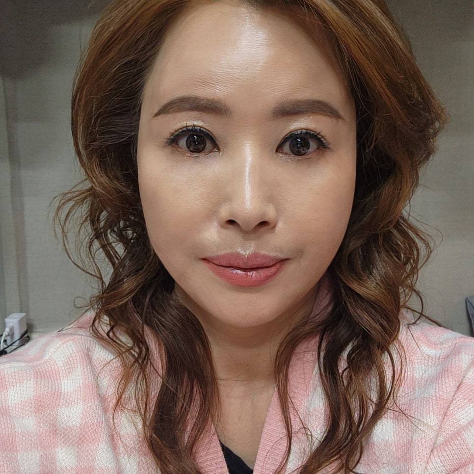 What Is the Difference Between Mini Lower Blepharoplasty and Under-Eye Fat Repositioning? image 1