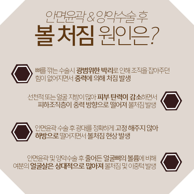 불독살제거로 턱선정리 성공~♡ 관련 이미지 2