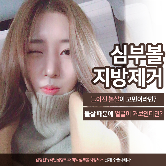 늘어진볼살 제거하는법이 궁금해? 관련 이미지 2