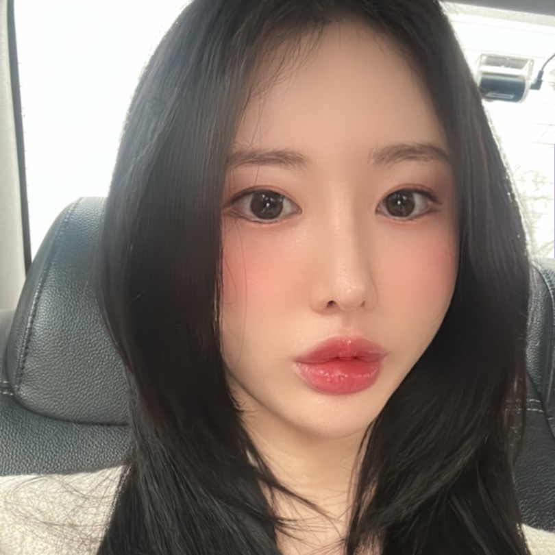 신사눈밑지 애교살 밑으로 접히는 눈 밑 지방 해결했어요 관련 이미지 3