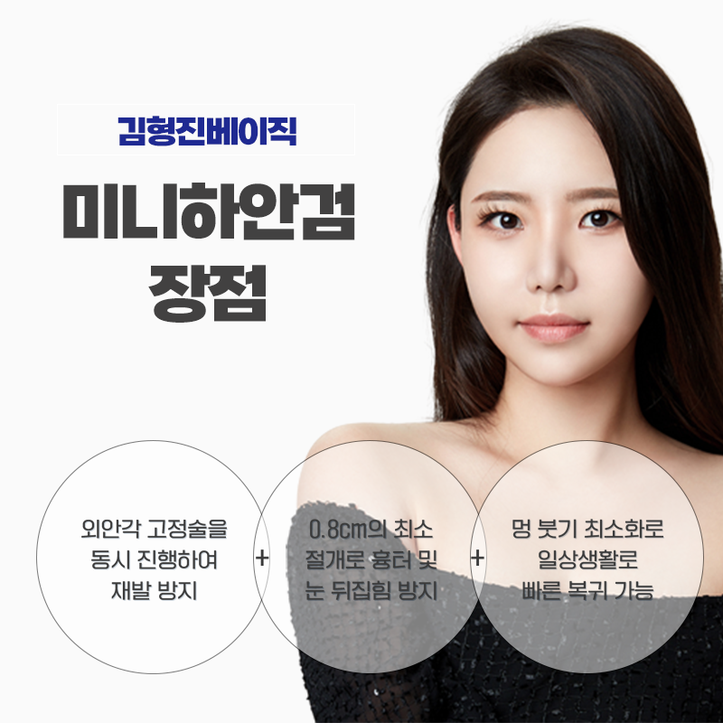 미니하안검흉터 걱정 되신다구요? 김형진베이직이 있잖아요! 관련 이미지 4