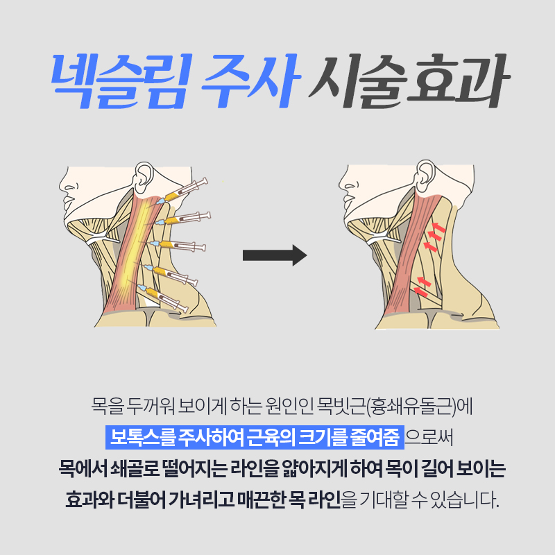 넥슬림보톡스 누가 해야되냐면요 관련 이미지 2