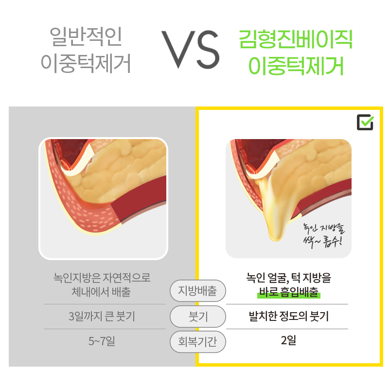 당신만 몰랐던 진짜 턱살없애는방법 알고싶다면 관련 이미지 5