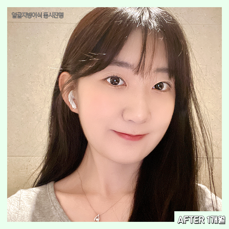 얼굴살빼는법 이렇게 간단한 방법이? 관련 이미지 6