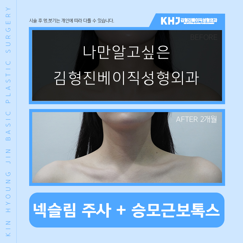 넥슬림주사효과 극대화 시키고 싶다면 관련 이미지 5