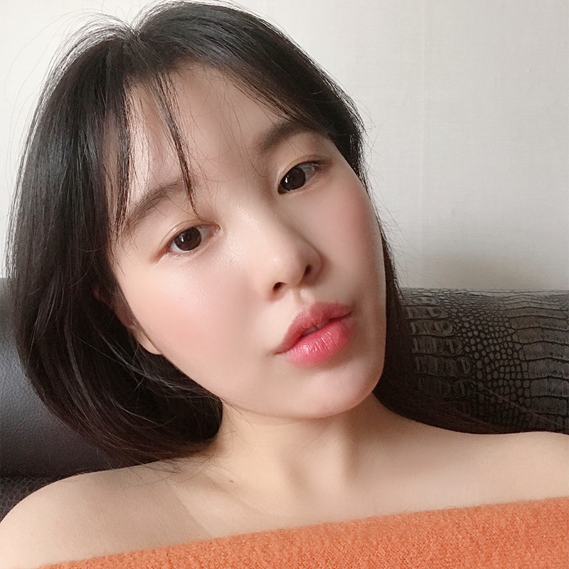 입꼬리필러전후 보고 가실래요? 관련 이미지 1