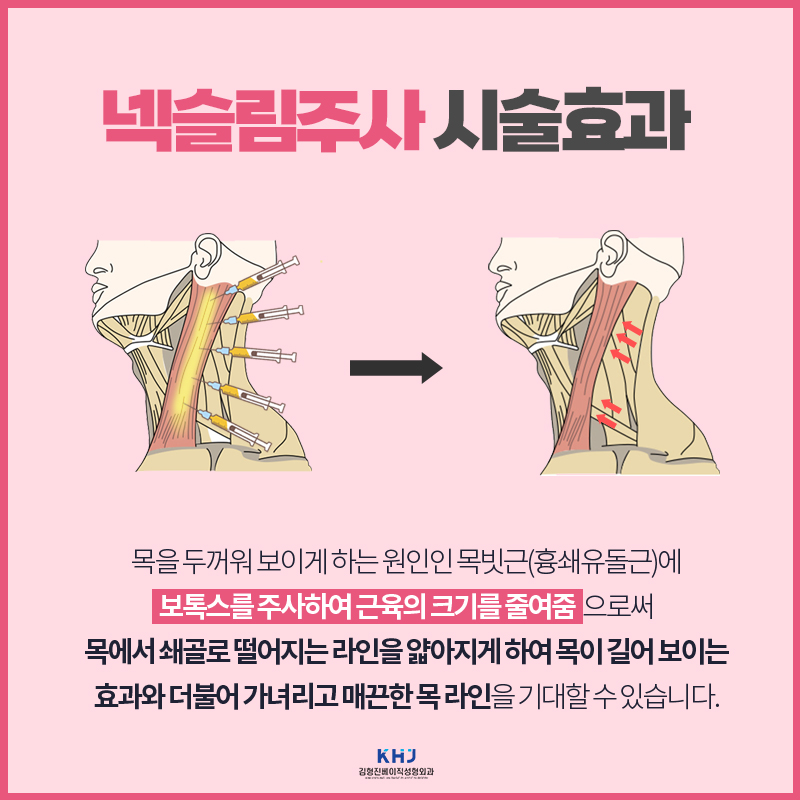 넥슬림주사후기 이보다 확실한 차이는 없을듯... 관련 이미지 3