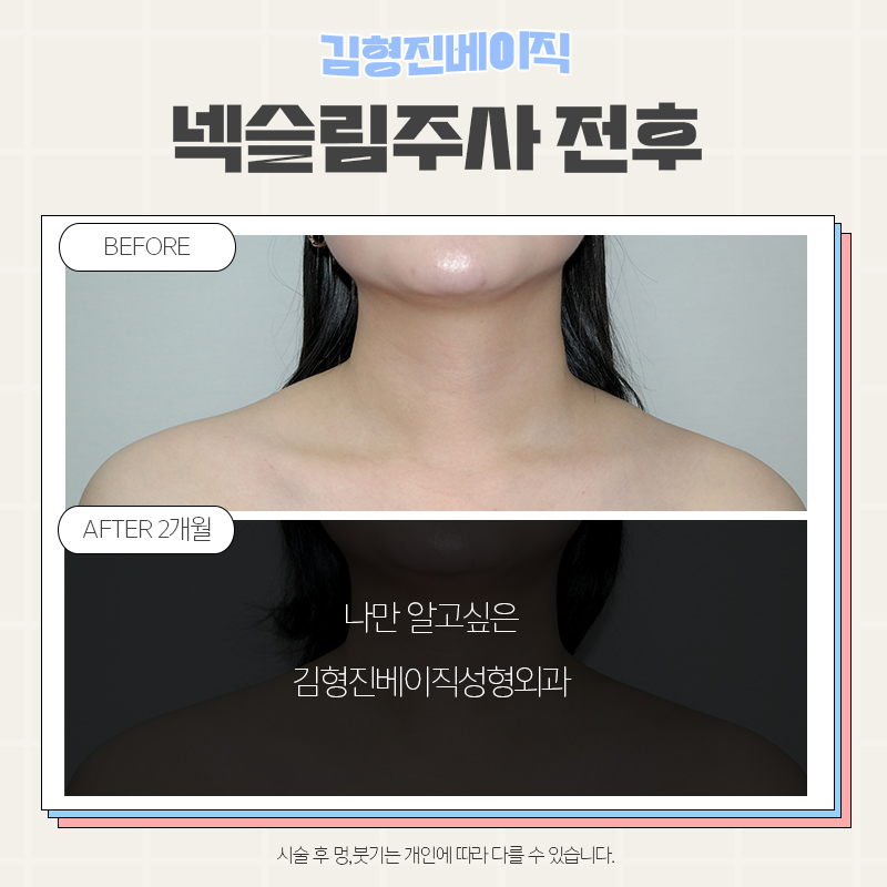 웨딩관리는 김형진베이직에서 하셔야죠! 관련 이미지 2
