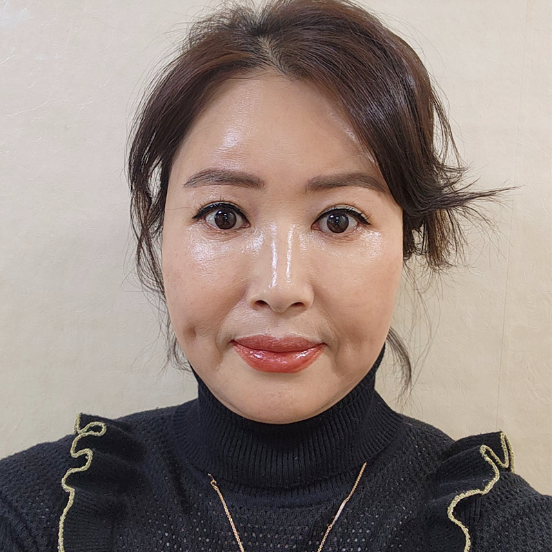 중년눈밑처짐 해결 원하신다면 김형진베이직에서! 관련 이미지 1