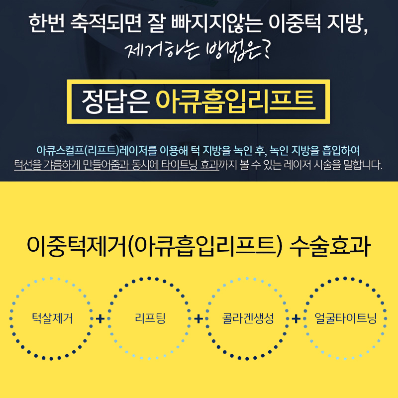 이중턱수술로 턱살부터 탄력까지 완벽하게 개선했어요! 관련 이미지 3