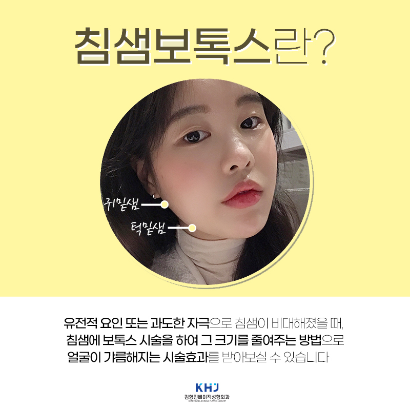 침샘보톡스후기 이걸로 종결합니다ㅠㅠ 관련 이미지 4