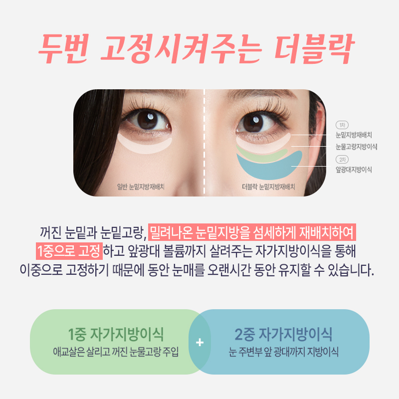 눈밑지방재배치흉터 보이지 않는 게 맞아요! 관련 이미지 2