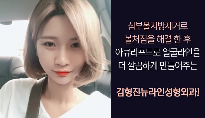 윤곽후볼처짐 해결책은 김형진뉴라인성형외과 소프트V라인 관련 이미지 5
