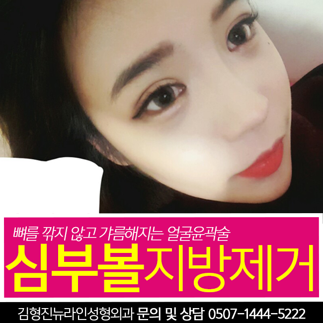 심부볼제거후기 진짜니까 드루와~ 관련 이미지 1