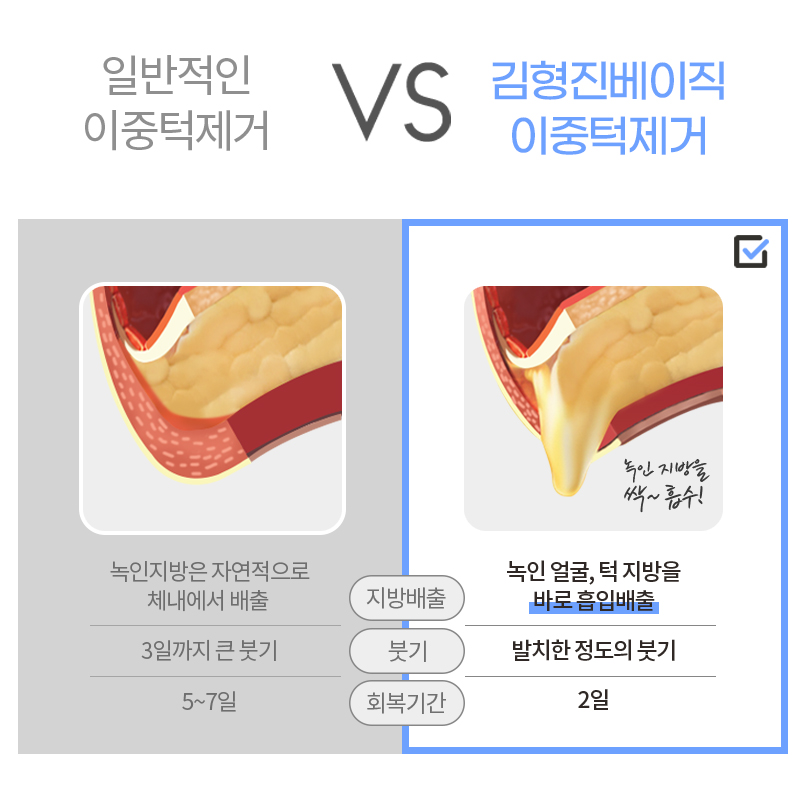 올해 가기 전에 얼굴살빼는수술 필요한 사람? 관련 이미지 5