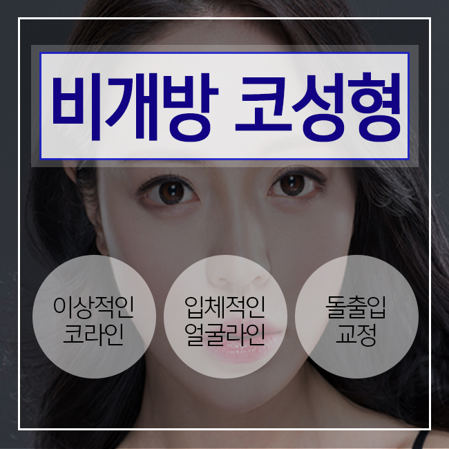 비개방코성형 개방형과 차이 알아보기! 관련 이미지 3