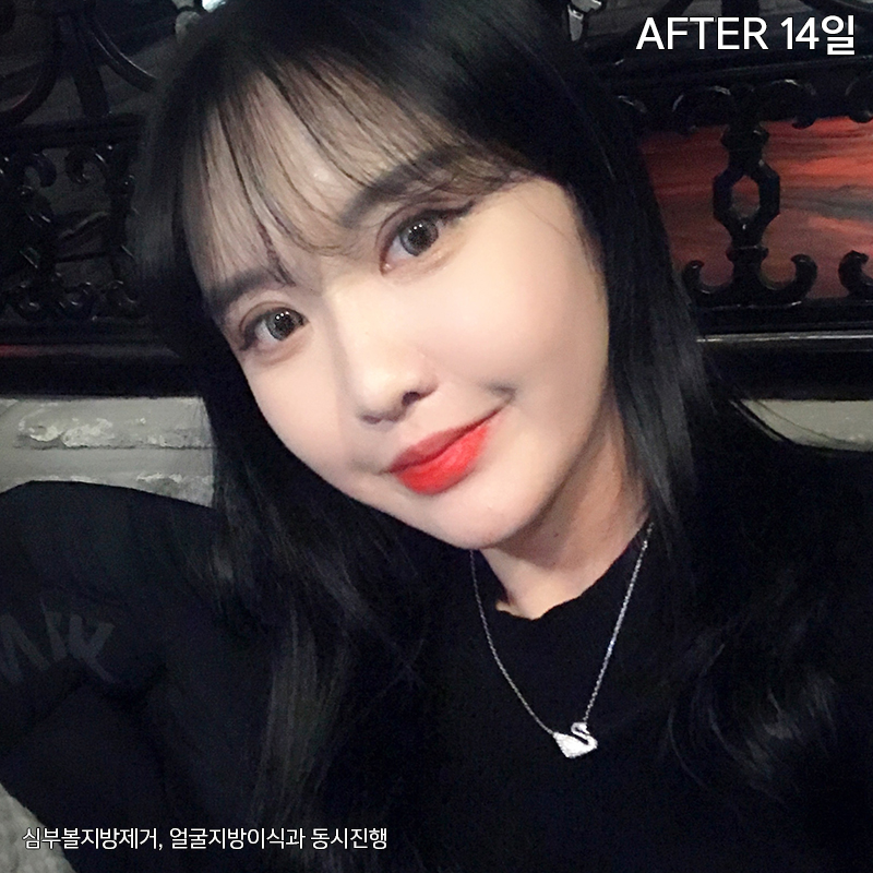 이중턱해결법 아직 모르신다구요? 관련 이미지 5