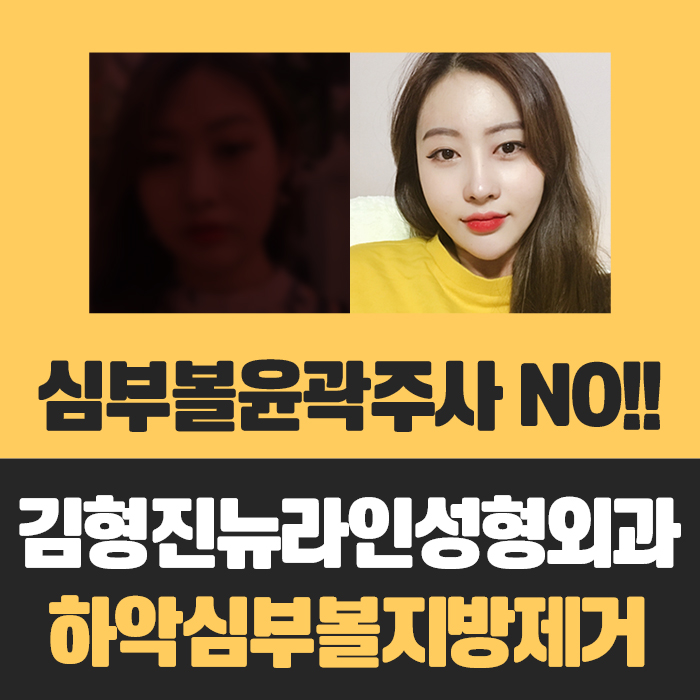 심부볼윤곽주사 누가 가능하대? 관련 이미지 1