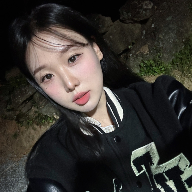 김형진베이직 얼굴지방흡입수술 변화 확실한 곳 관련 이미지 2