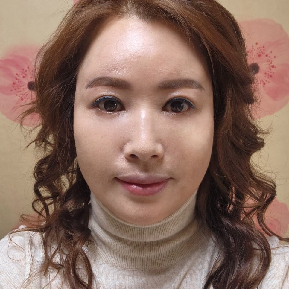 눈밑처짐수술 계속 고민 중이라면 관련 이미지 2