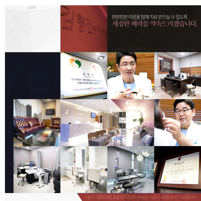 코성형종류 나에게 알맞은 것은~? 관련 이미지 6
