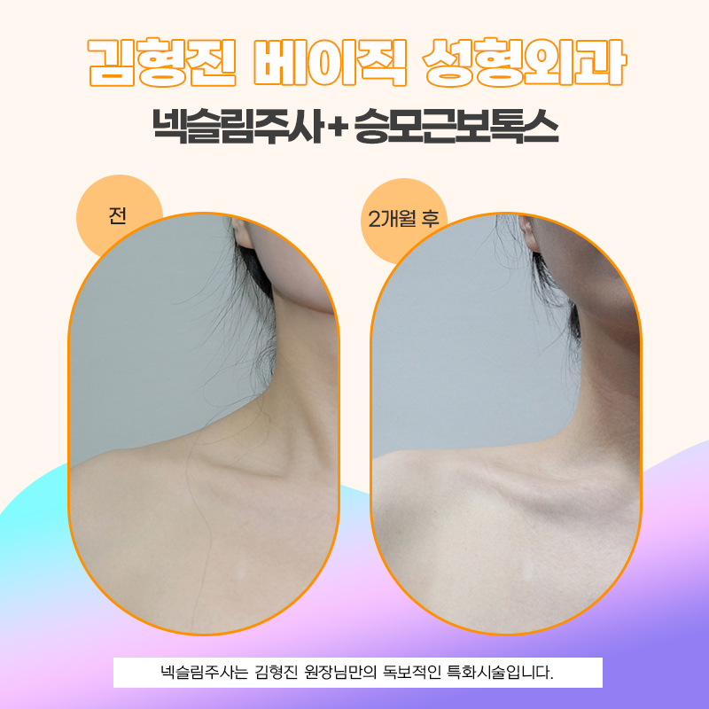 넥슬림주사효과 목선까지 슬림하게 만들려면 관련 이미지 5