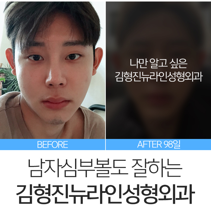 남자심부볼 깔끔하게 정리해요 관련 이미지 8