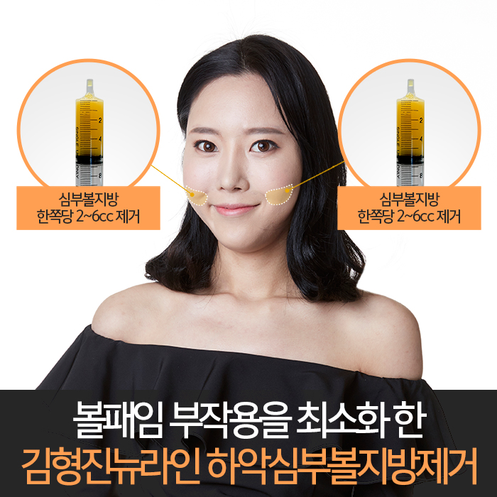 심부볼효과 확실하니까 관련 이미지 6