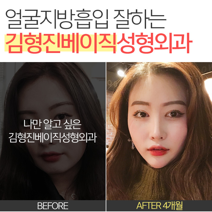 얼굴작아지는법 이것저것 하지말고 하나만 딱! 관련 이미지 7