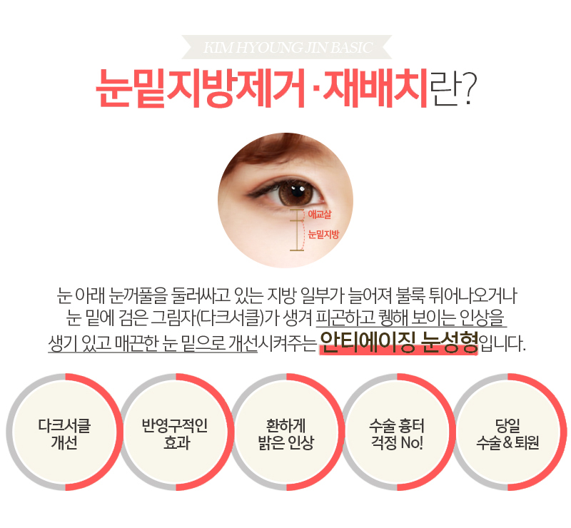 눈밑지방재배치후기가 증명하는 재발 없이 눈 밑 지방 정리 방법 관련 이미지 3