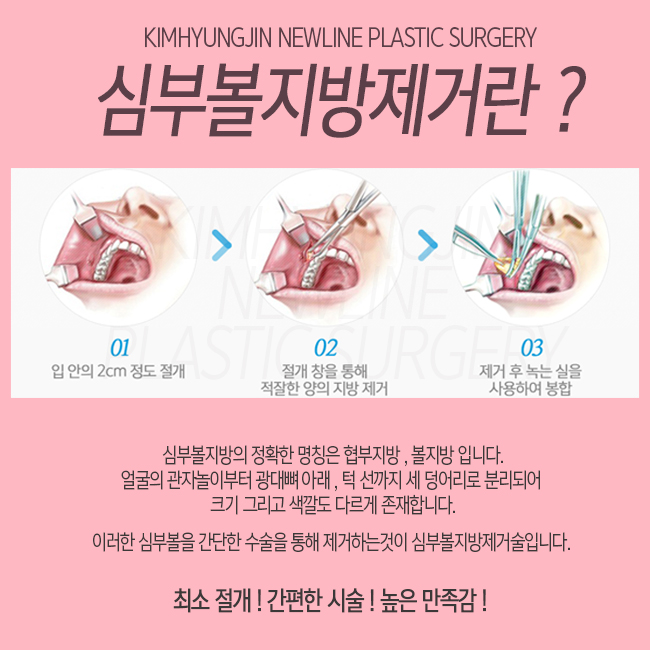 심부볼 지방제거 완벽한 라인 ~ 관련 이미지 2