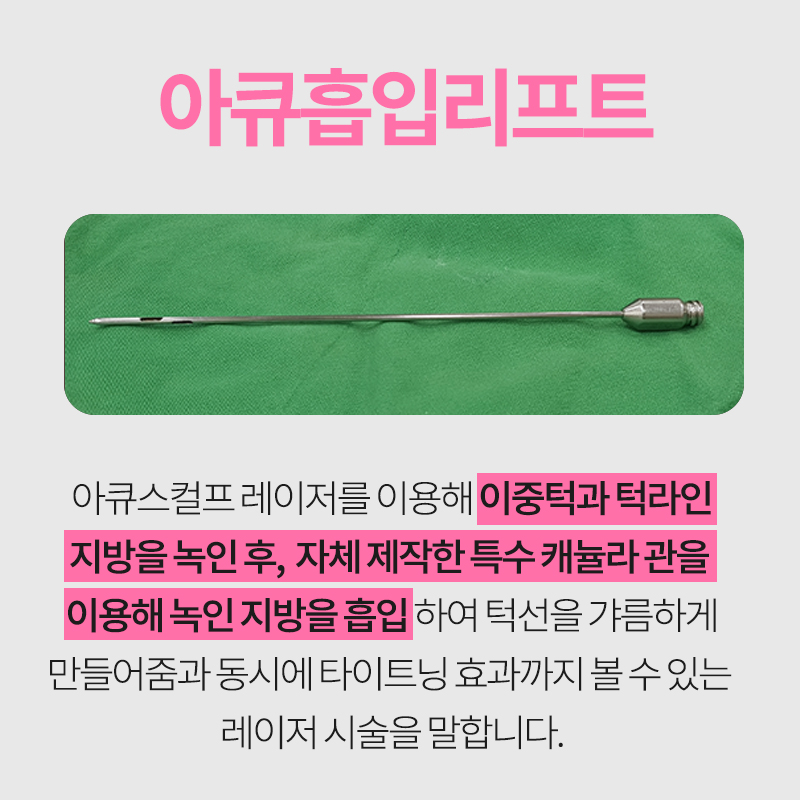 이중턱지방흡입전후 차이가 큰 김형진베이직 관련 이미지 4