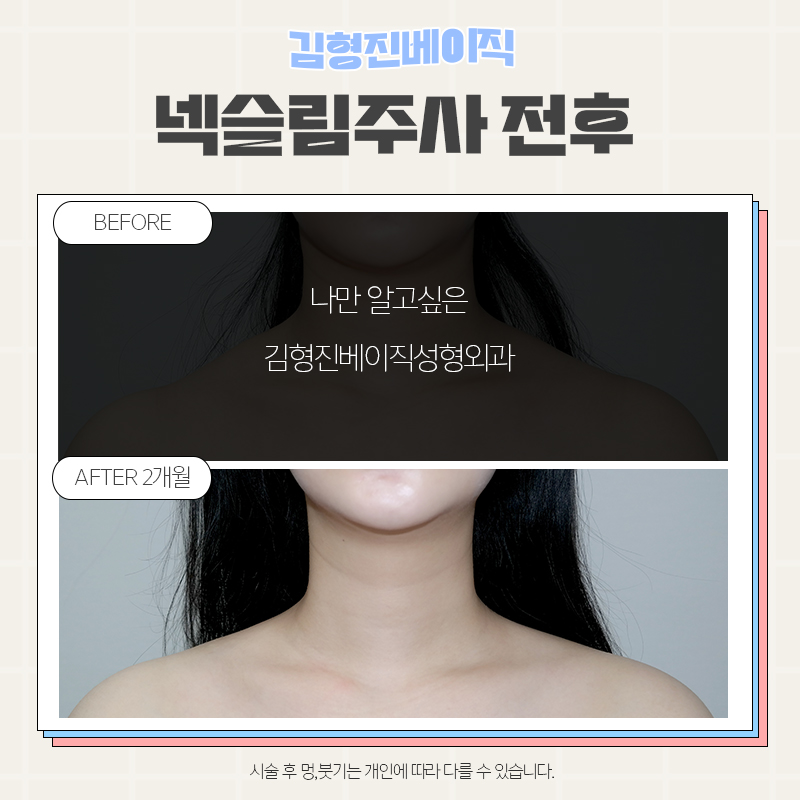 웨딩관리는 김형진베이직에서 하셔야죠! 관련 이미지 5