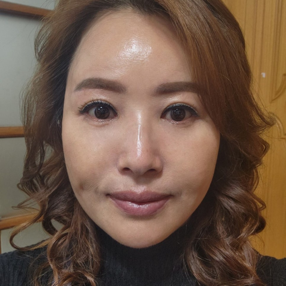 일단 효도성형후기 보고 결정하세요! 관련 이미지 2