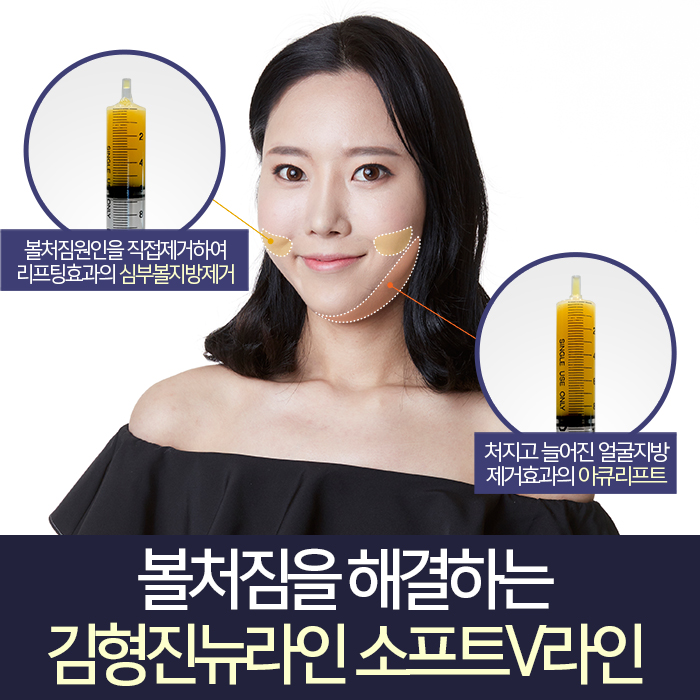 광대볼처짐 이렇게 해야 되요! 관련 이미지 4