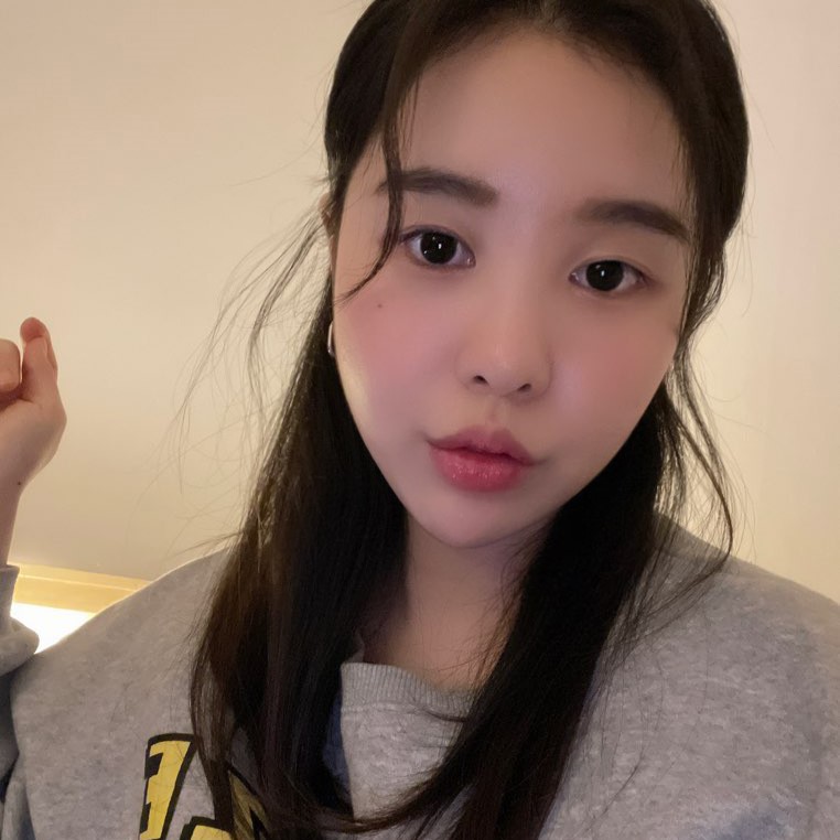 압구정입꼬리필러후기 이만큼 만족스러울 수가 없어요 관련 이미지 3