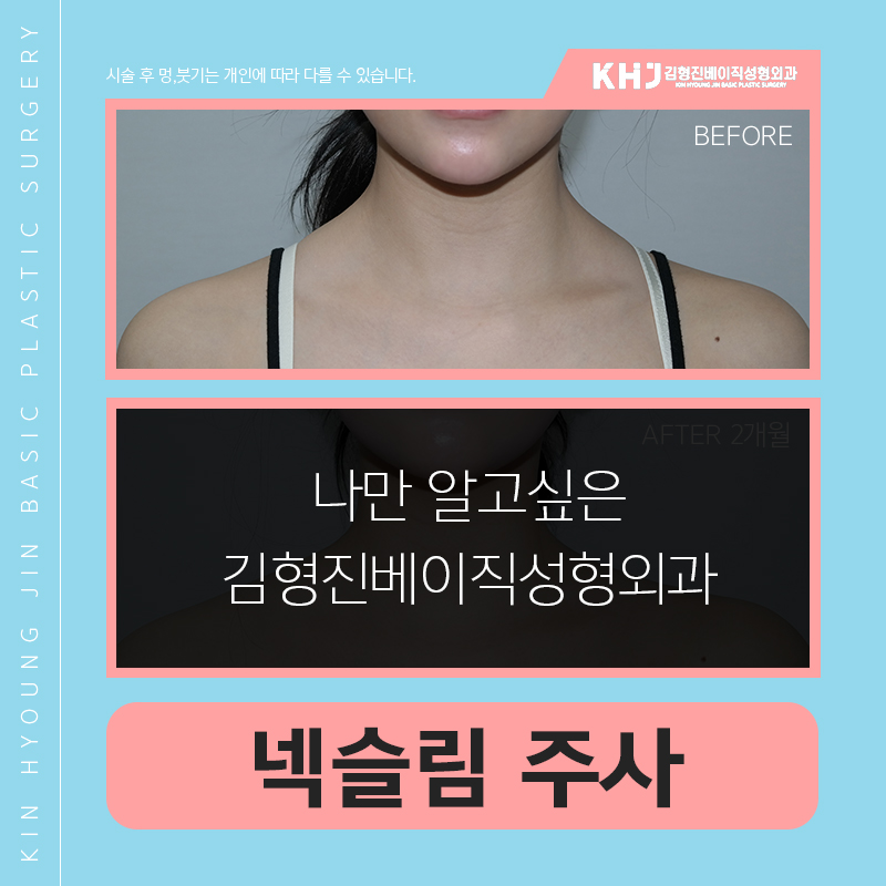 넥슬림주사후기 궁금하시죠? 관련 이미지 3