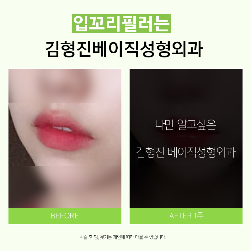 예쁜입술 되는방법, 별거없어요! 관련 이미지 2