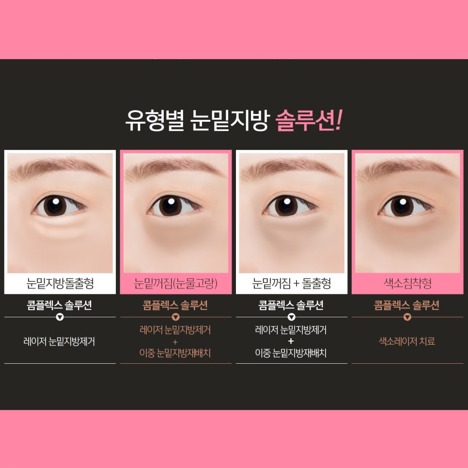 압구정눈밑수술 아직도 마음에 드는 곳이 없다면 관련 이미지 4