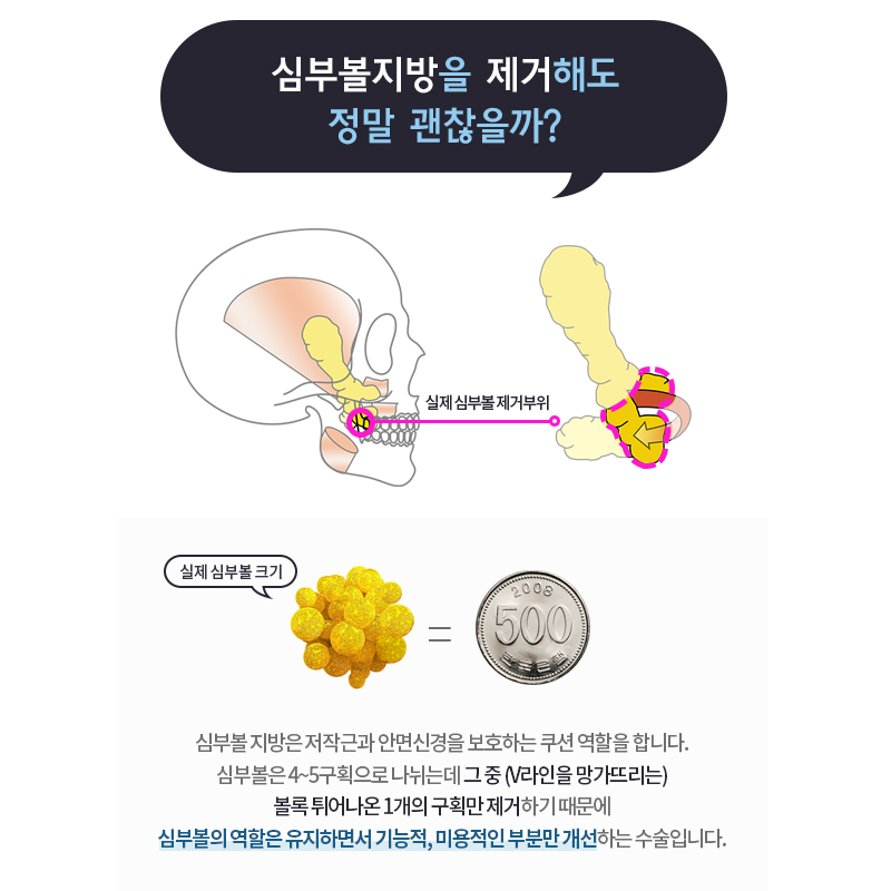 하악심부볼제거로 갸름한 얼굴라인을! 관련 이미지 3