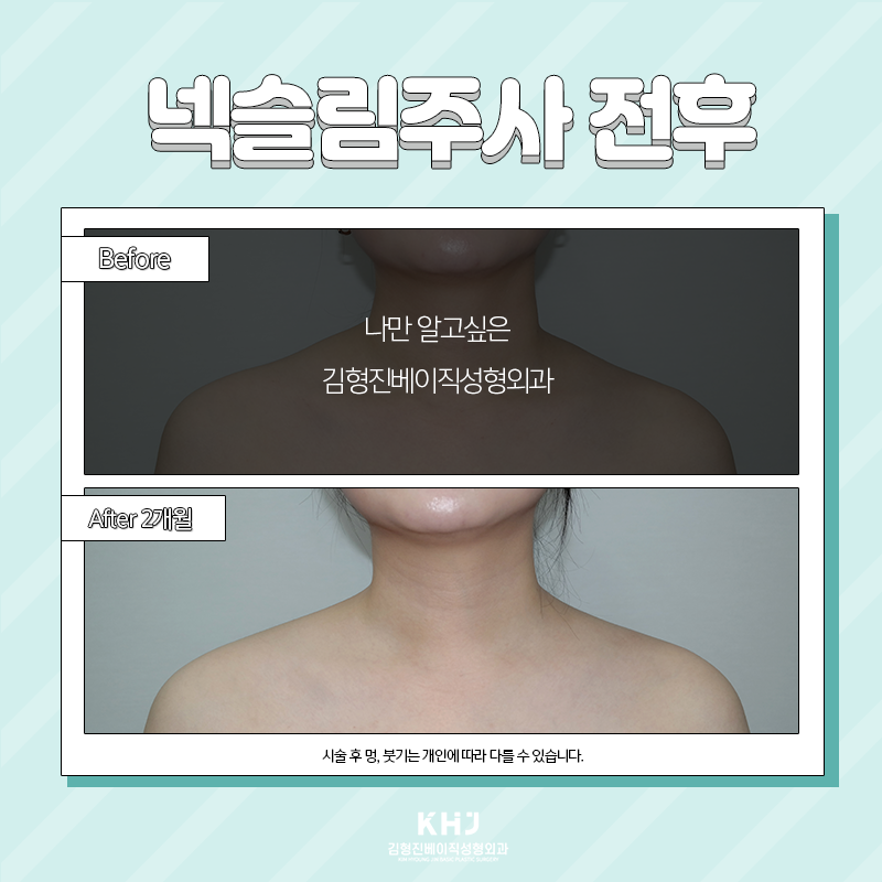 목얇아지는법 궁금하셨다면? 관련 이미지 5