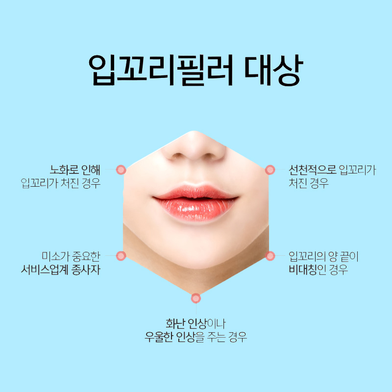 입꼬리시술로 자연스러운 미소라인 만드는 법 관련 이미지 5