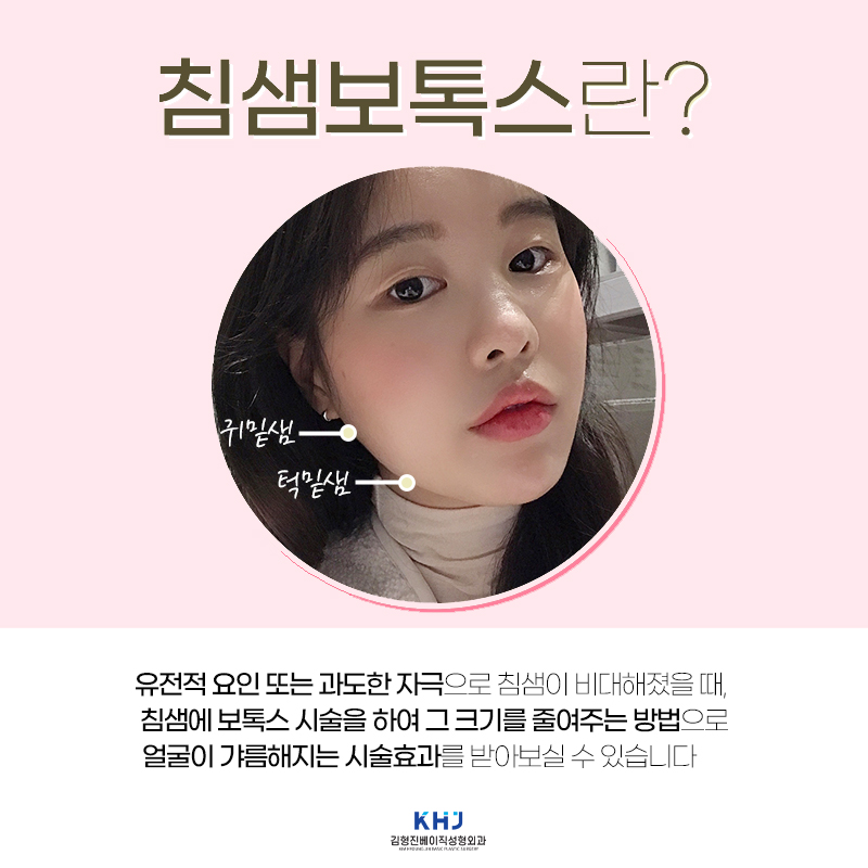 압구정침샘보톡스로 뭉툭한 턱라인 깨끗하게 정리해요! 관련 이미지 3