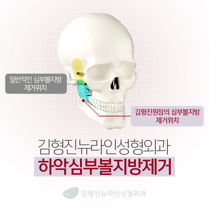 볼살없애는법 그동안 잘못 알고있던 사실 관련 이미지 4