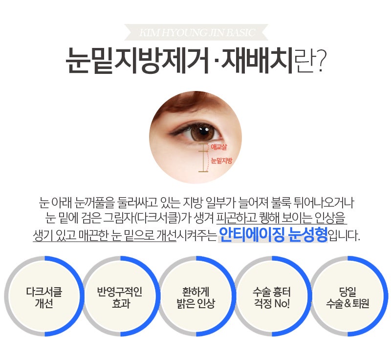 Why I Never Had to Go Back After Lower Eyelid Fat Removal image 4