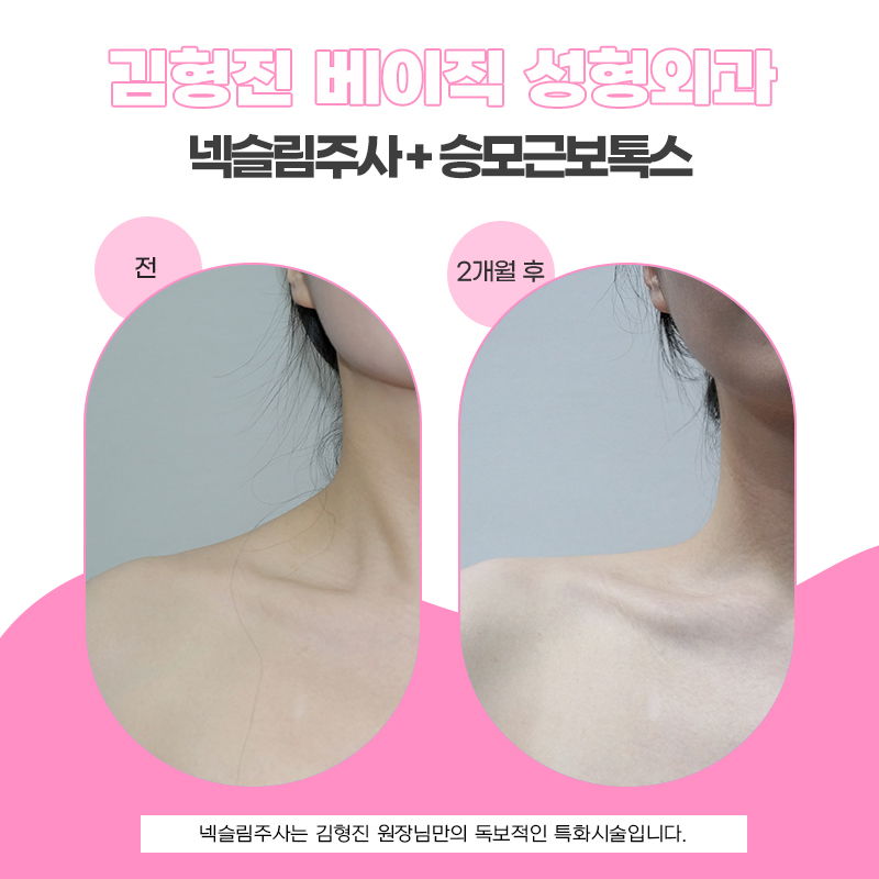 신부관리 넥슬림주사로 슬림하고 긴 넥 라인 완성해요! 관련 이미지 5