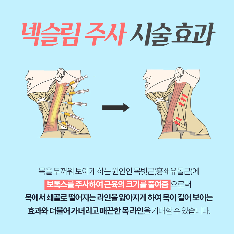 넥슬림주사효과 극대화 시키고 싶다면 관련 이미지 2