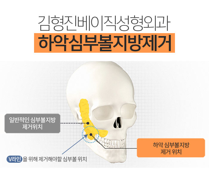 볼갸름해지는법 다 알고 있는데 관련 이미지 6